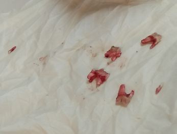 teeth